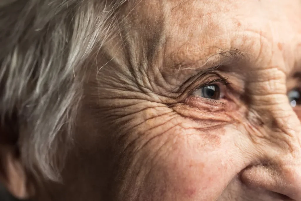 What Causes Skin Wrinkles? Essential Facts