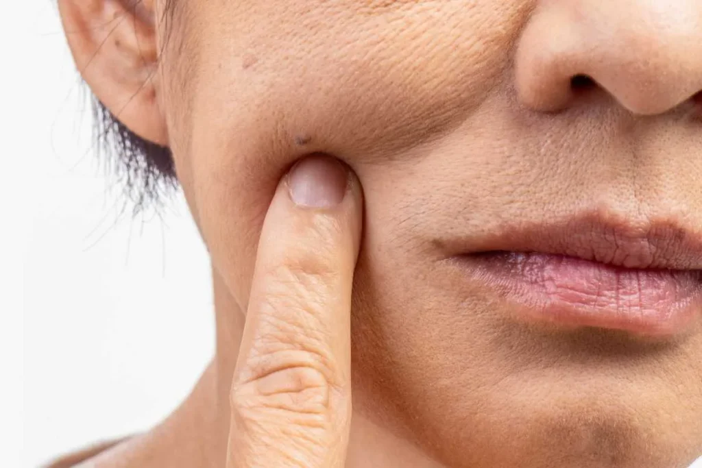Old Woman Wrinkles: Proven Removal Tips