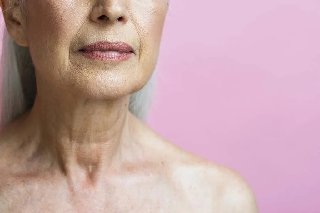 Types Of Wrinkles: How To Identify Them
