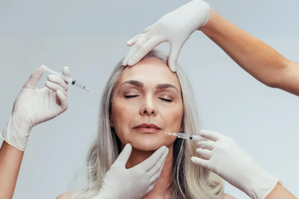 Lip Fillers For Lip Lines: Expert Tips