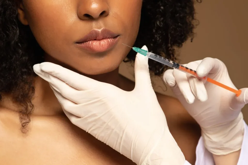 Does Filler Ever Go Away? The Truth