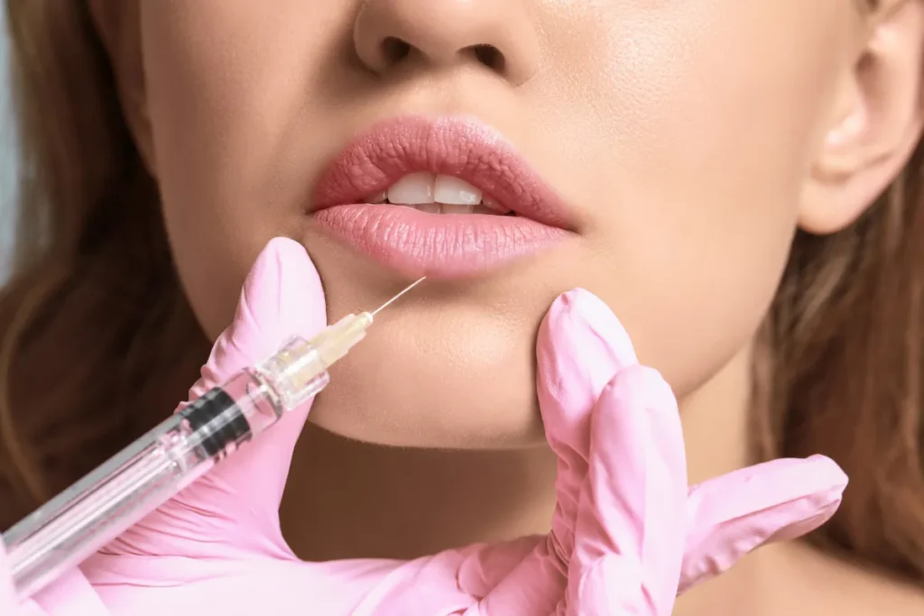 What Does Lip Filler Look Like? Visual Guide