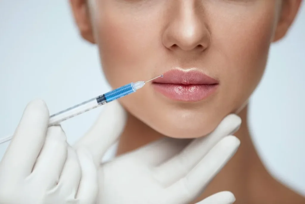 Small Mouth Lip Fillers: Incredible Makeover