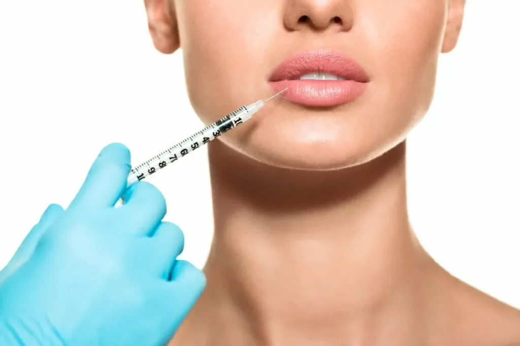 How Long Do Lip Fillers Last? Best Survival Guide