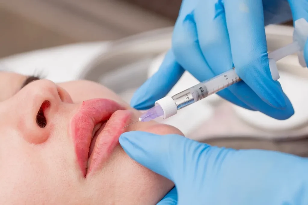 Lips Hyaluron: Incredible Needle-Free Volume