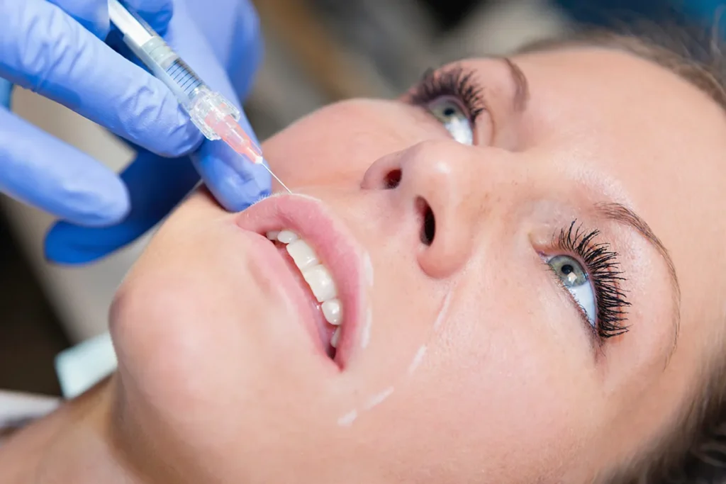 Hydro Lip Fillers: Brilliant Hydration Results