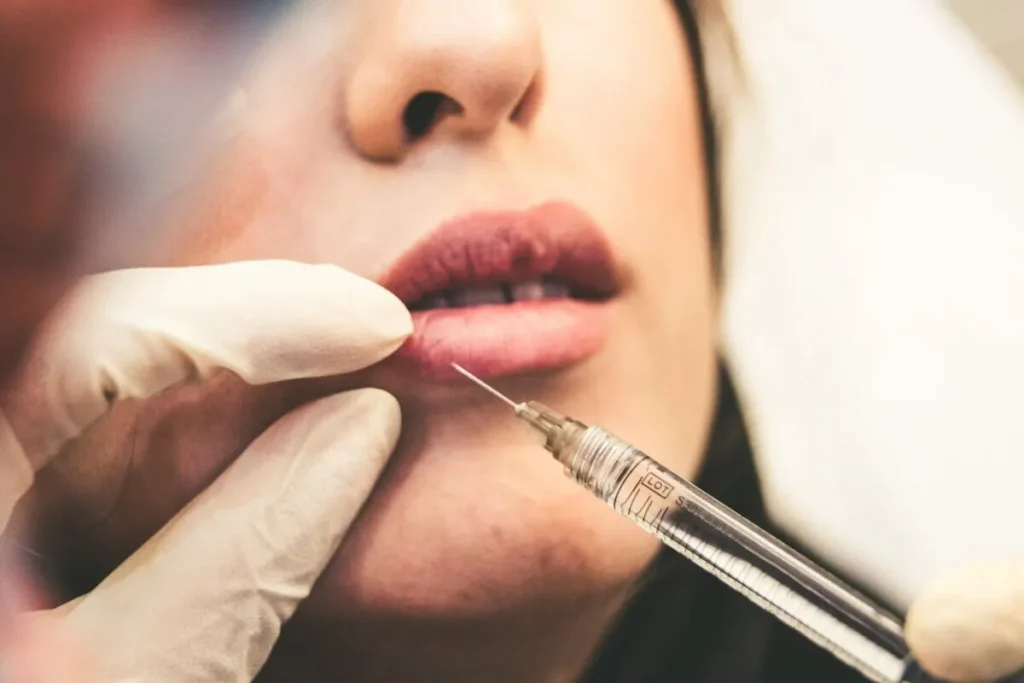 Hyaluronic Acid In Lips: Amazing Volume Tips