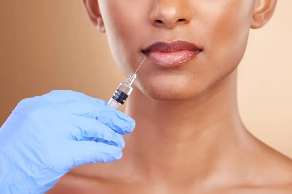 Hyaluronic Acid In Lips: Amazing Volume Tips
