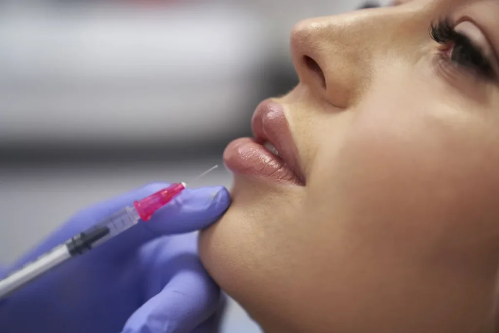Does Lip Filler Last Forever? The Surprising Truth