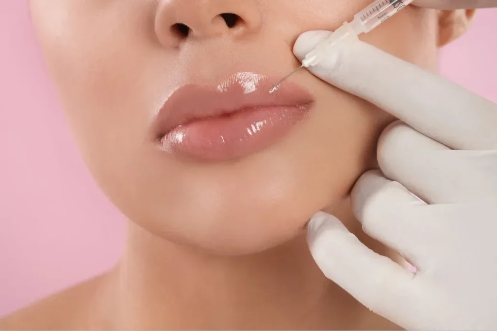 How Long Does Juvederm Lip Filler Last? Guide