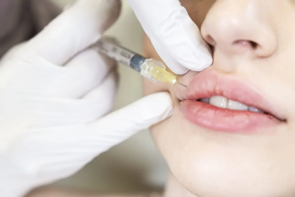 How Long Does Juvederm Lip Filler Last? Guide