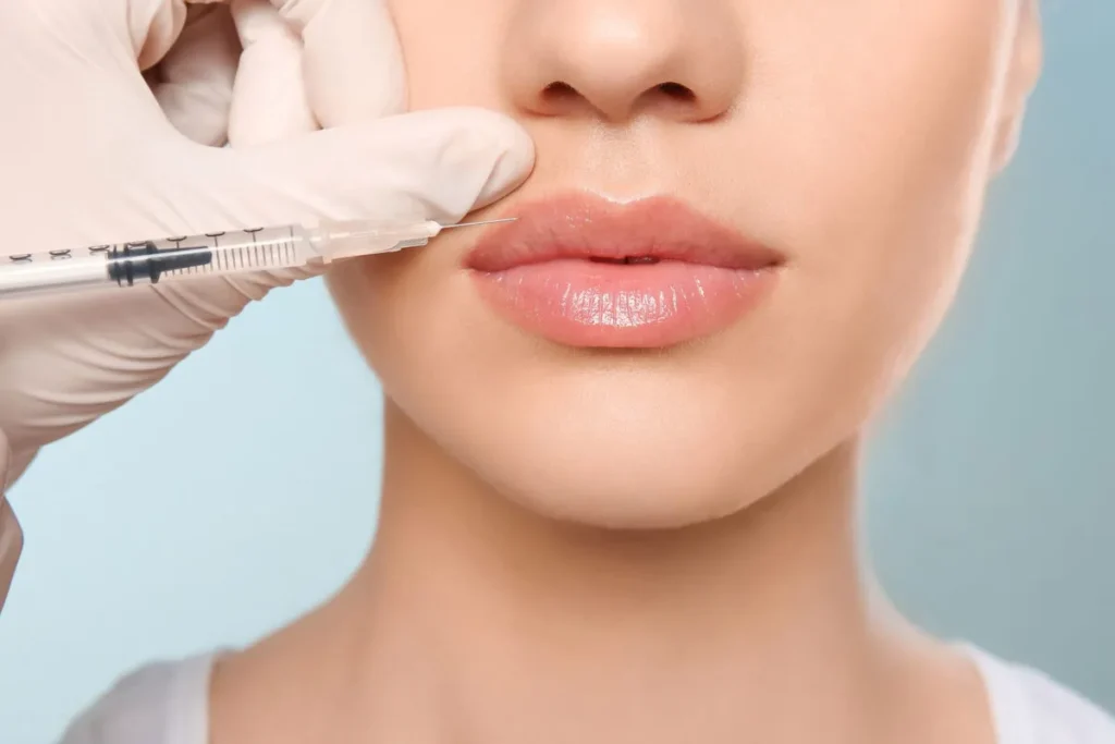 How Long Does Juvederm Last Lips: Amazing Tips