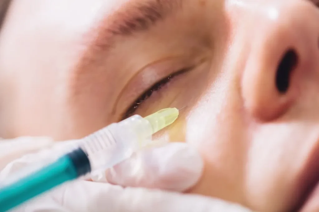Tear Trough Procedure: Brilliant Young Results