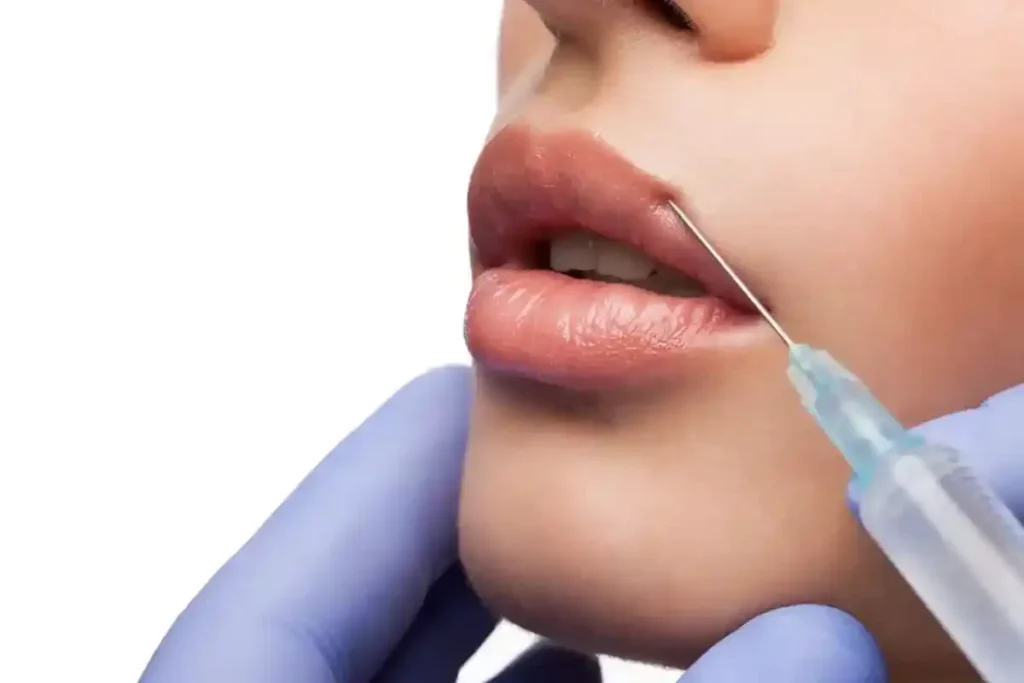 How Much Do Lip Fillers Hurt? The Honest Truth
