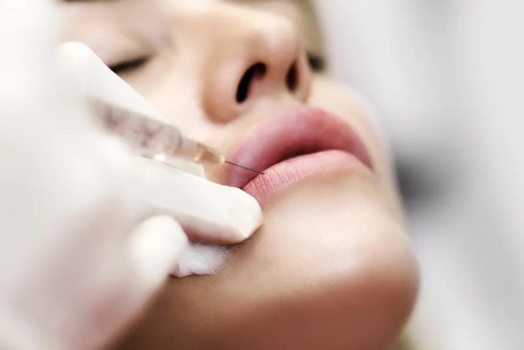 How Much Are Lip Implants? Powerful Cost Guide