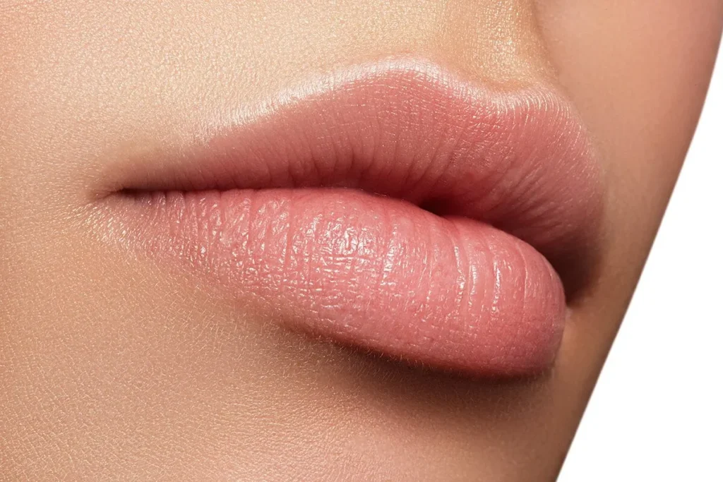 Juvederm Vollure Lips: Incredible New Look
