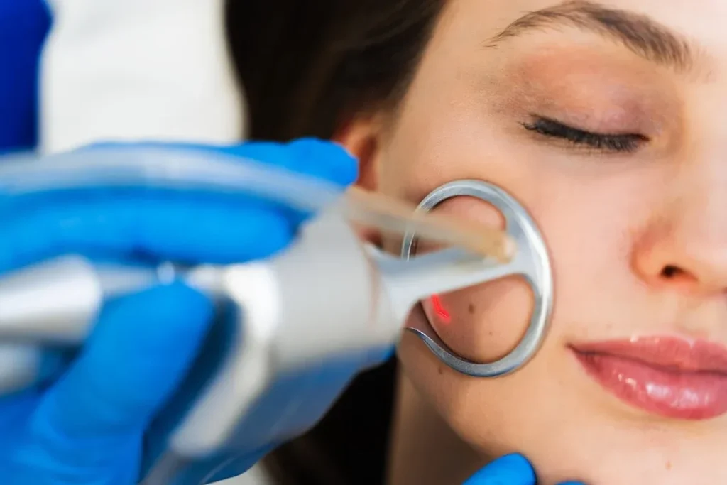 Scar Laser Redness: Brilliant Healing Guide