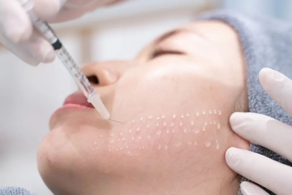 Meso Injection: Incredible Fat Burning Guide