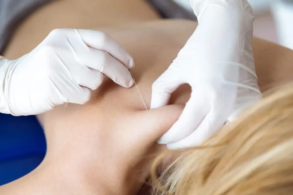What To Expect After Trigger Point Injections Now