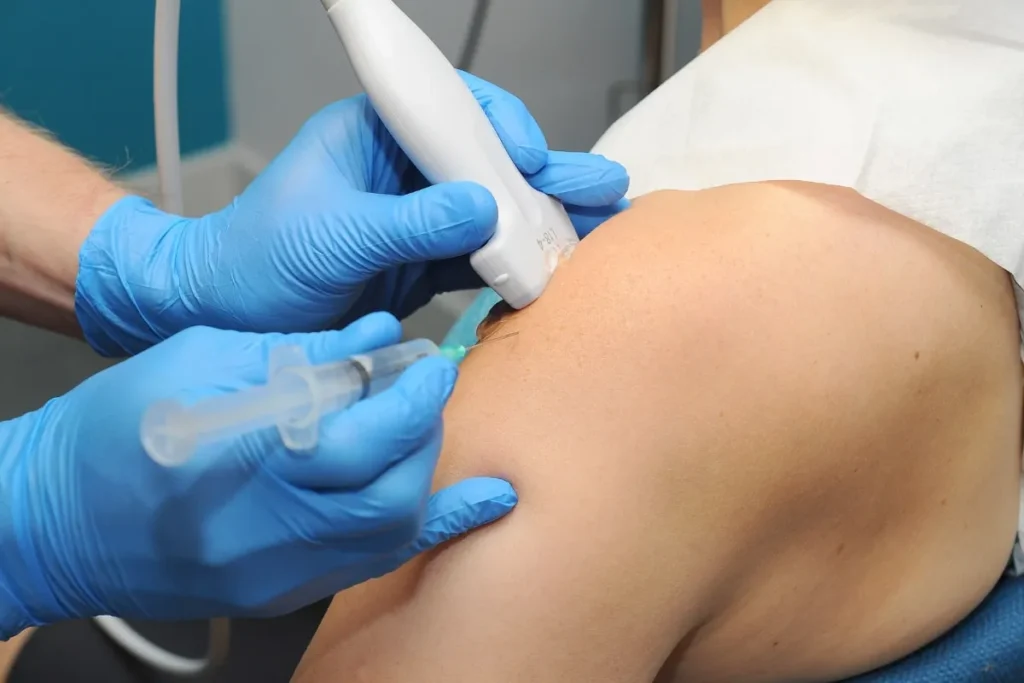 Muscle Trigger Point Injections: Best Benefits