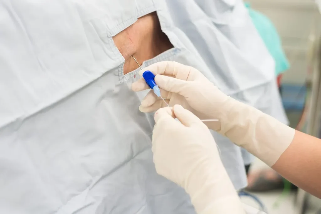 Epidurale steroïde injectie in de nek: Beste tips