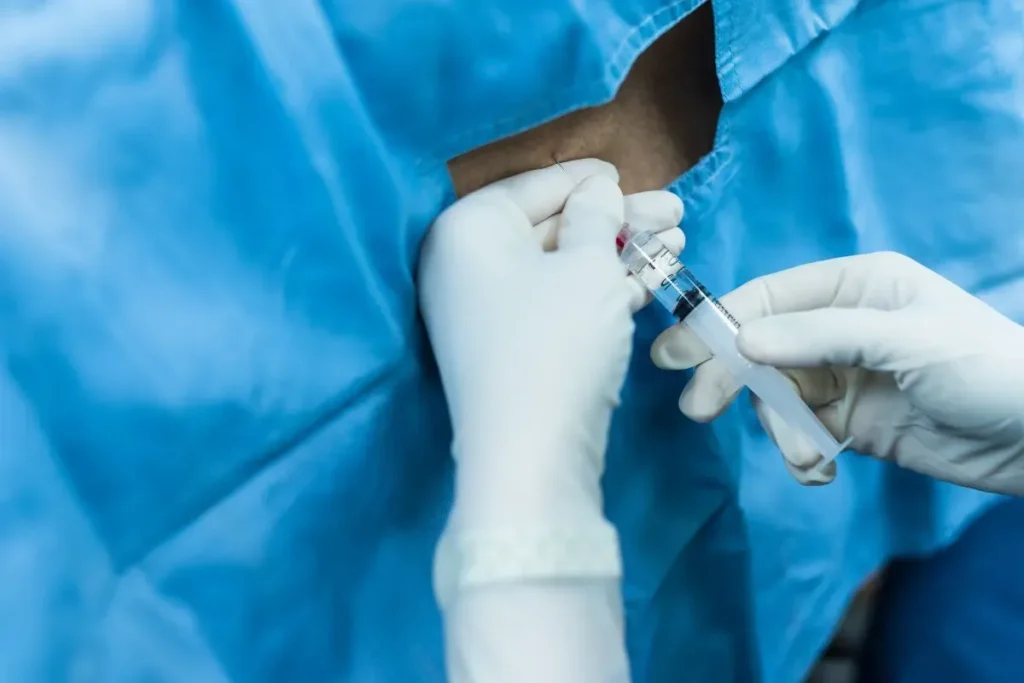 Epidural Steroid Injection Side Effects: Safety