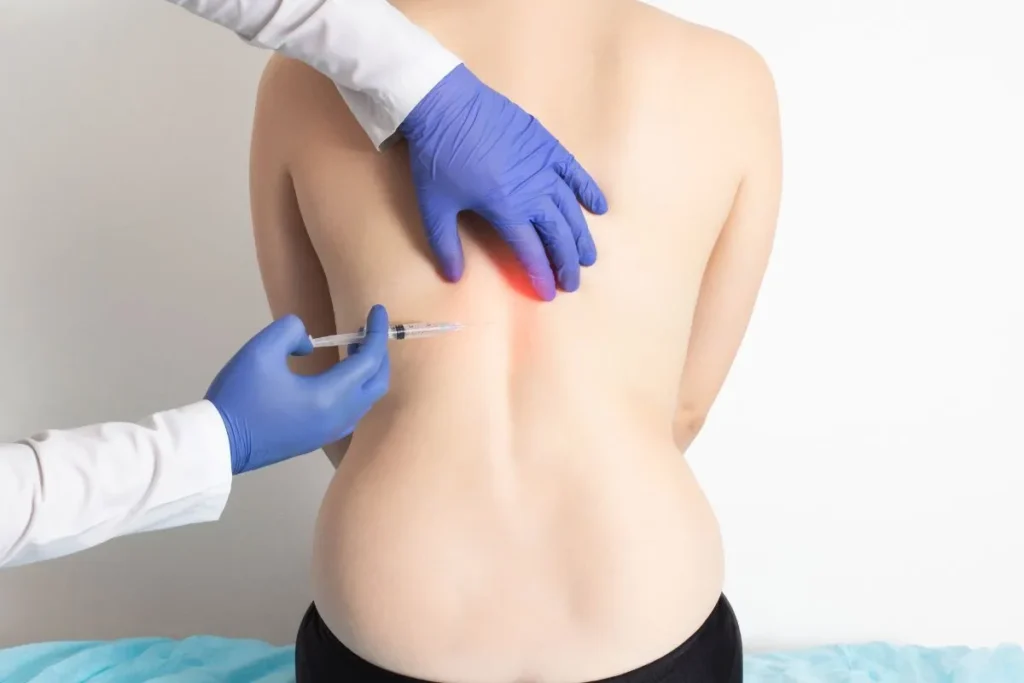 Back Pain Injections Names: Best Relief Guide
