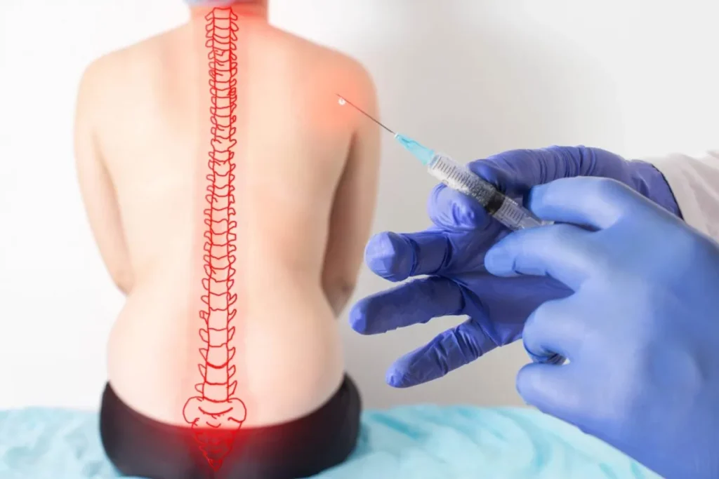 Back Pain Injections Names: Best Relief Guide