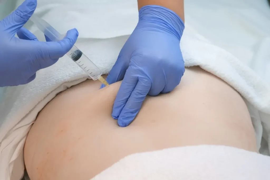 Types Of Back Injections: Powerful Relief Tips