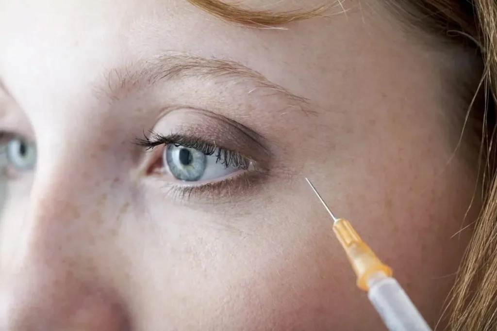 Under Eye Filler Lumps: Expert Solutions Now