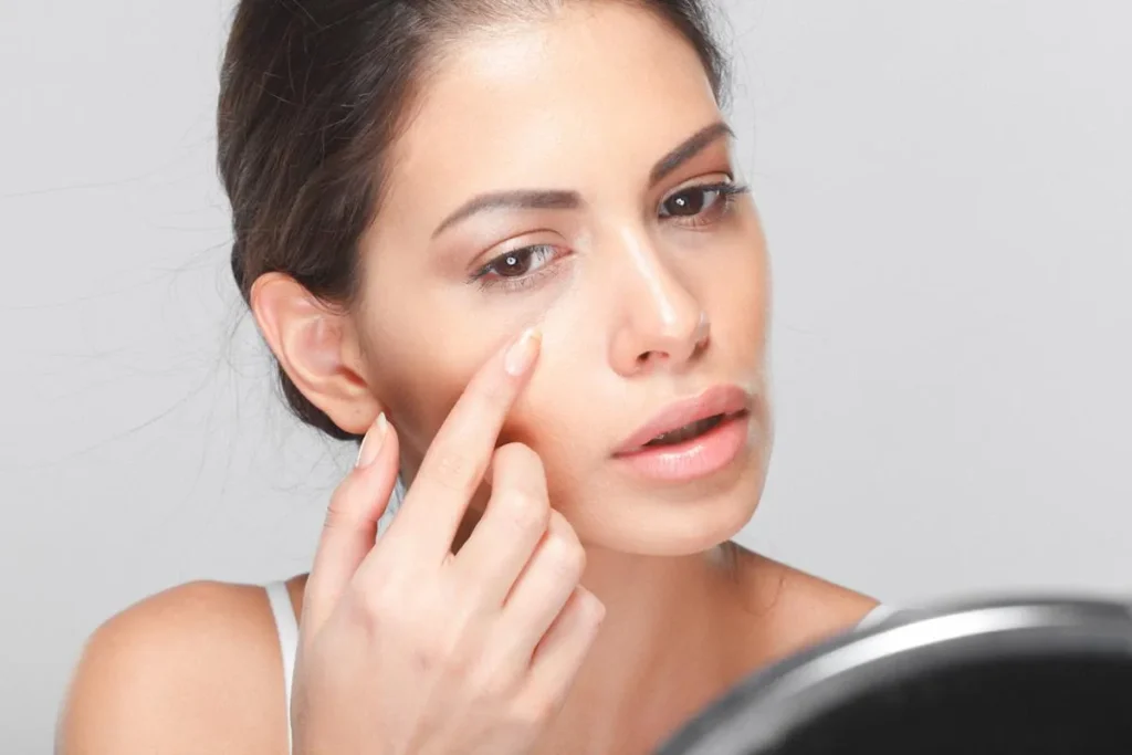 Under Eye Filler Swelling Months Later: Truth