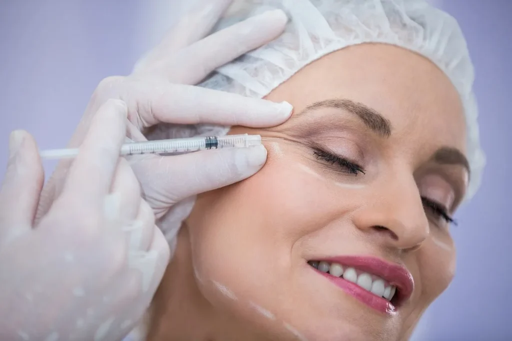Fillers For Under Eye Wrinkles Before And After