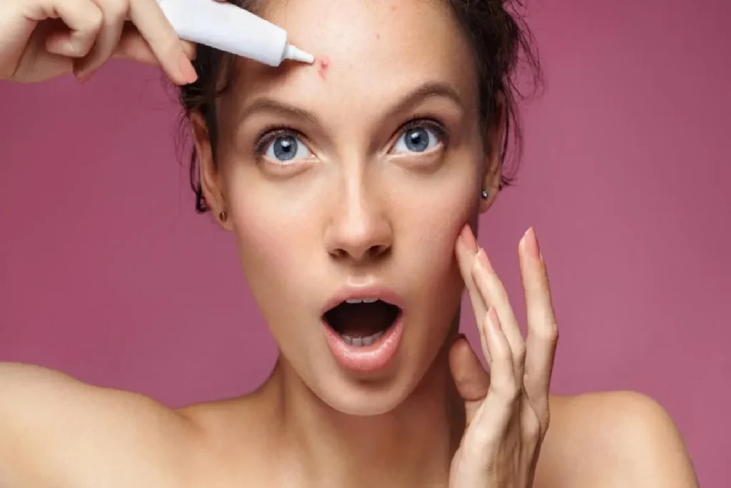 Hoe kom je snel van donkere vlekken af? Tips