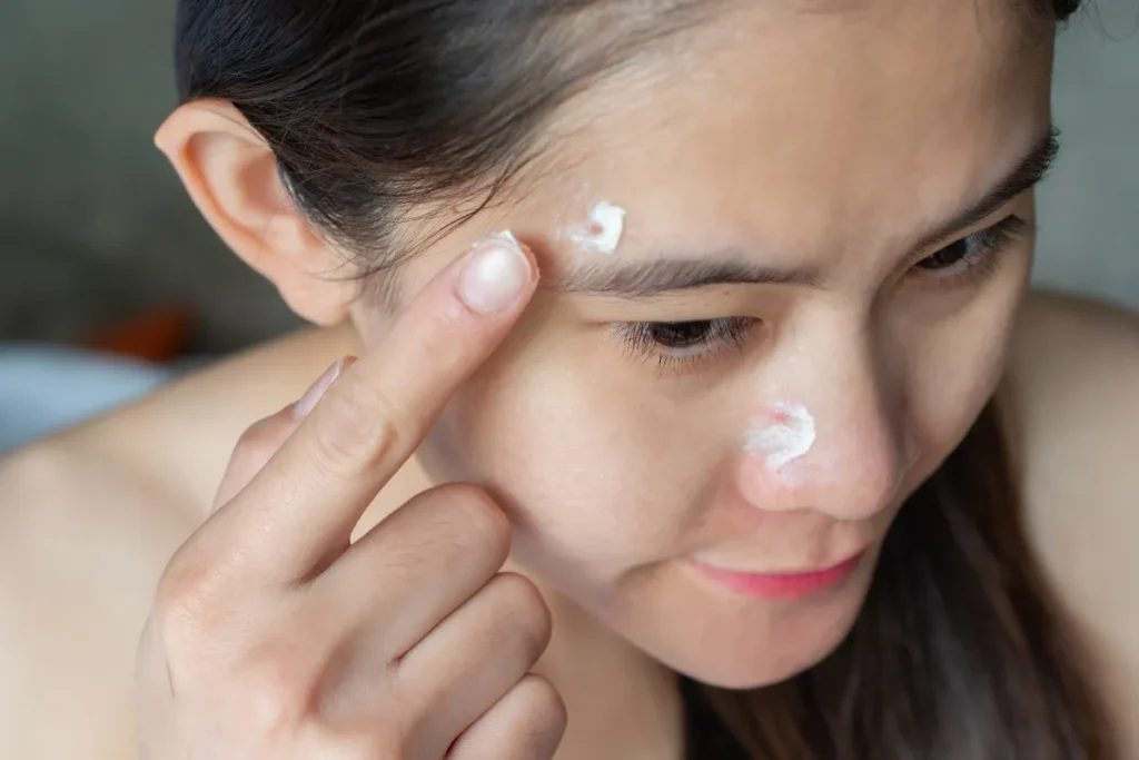 Whitening Scars: Best Amazing Results Fast