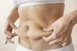 Skin Tightening After Weight Loss: Amazing Tips