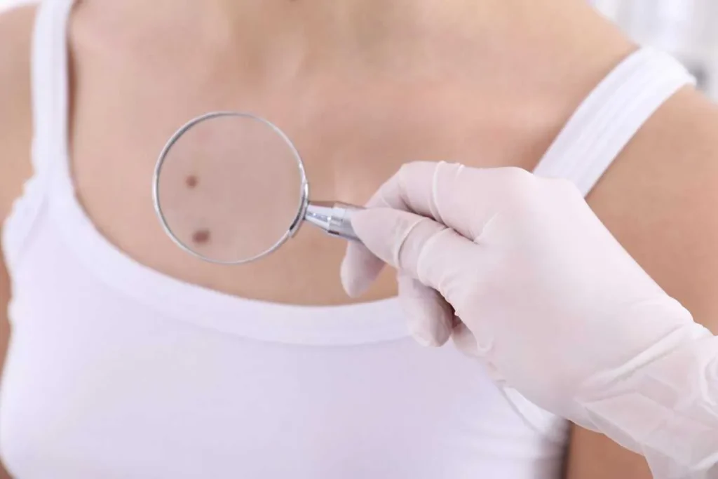 Brown Dots On Chest: Powerful Amazing Secrets