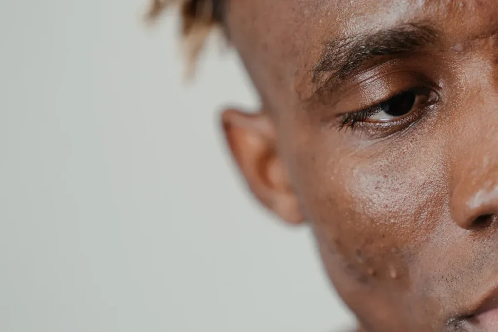 Black Skin Rash: Best Amazing Treatment Guide