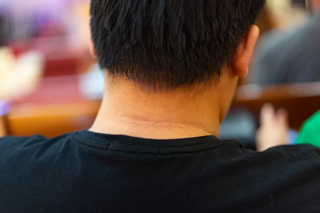 Darkening Of Skin On Neck: Powerful Tips