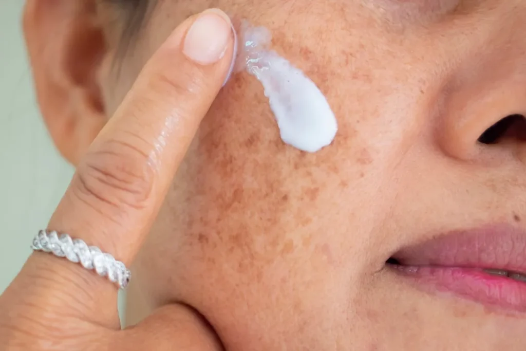 Brown Dots Appearing On Skin: Amazing Facts