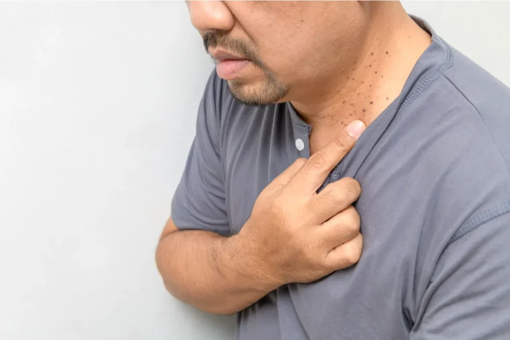 Dry Skin Turning Black: Powerful Amazing Relief