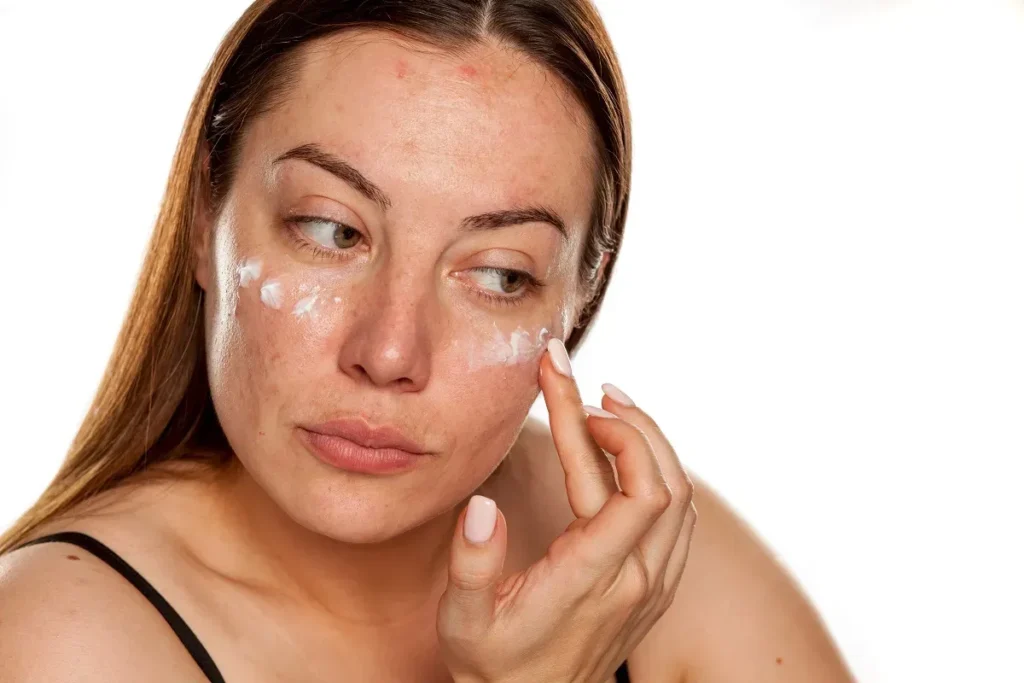Brown Spots On Skin That Peel Off: Best Tips