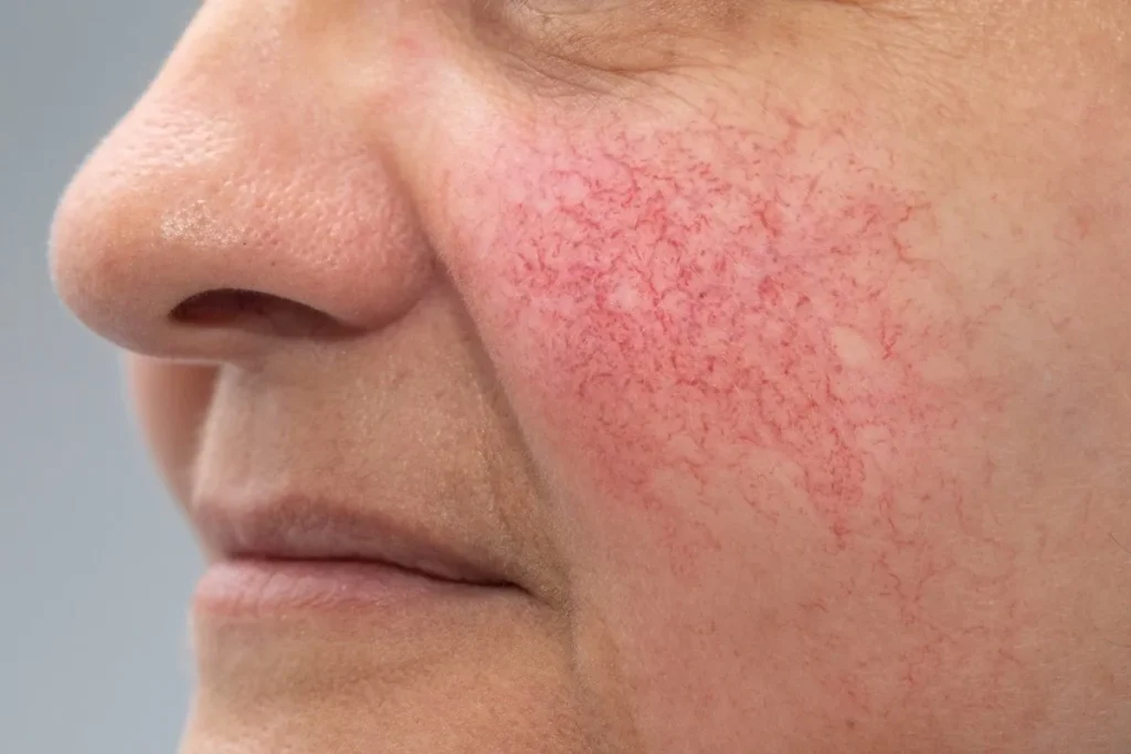 Waarom wordt mijn litteken rood? Vitale Geheimen