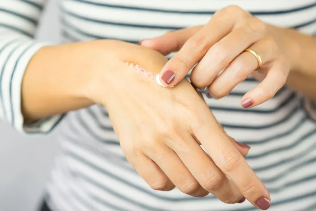 Wat veroorzaakt littekens? Krachtige Verbazingwekkende Geheimen