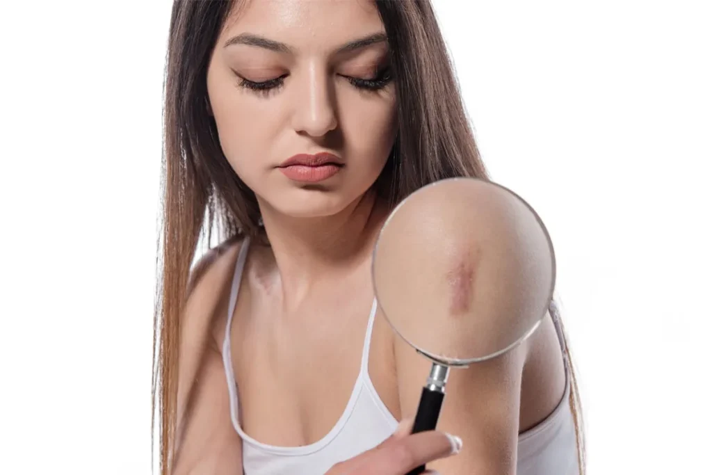 How Do I Know If I Have Scar Tissue? Best Tips