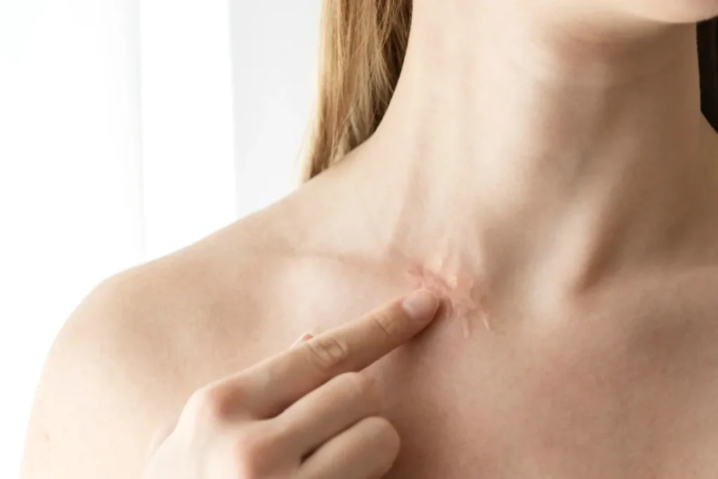 How Do I Know If I Have Scar Tissue? Best Tips
