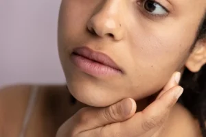My Skin Is Getting Darker For No Reason: Help