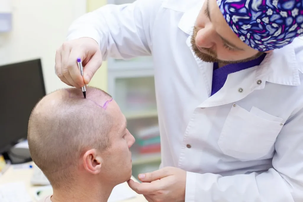 Essential Alopecia Blood Work Tests and Their Significance