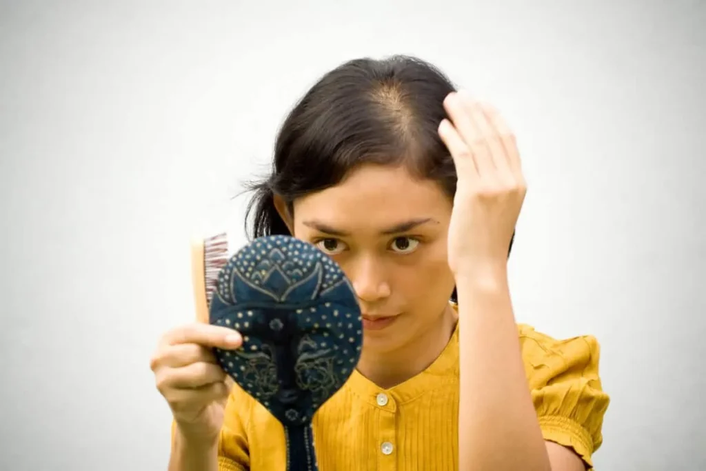 Understanding Alopecia and Its Prevalence