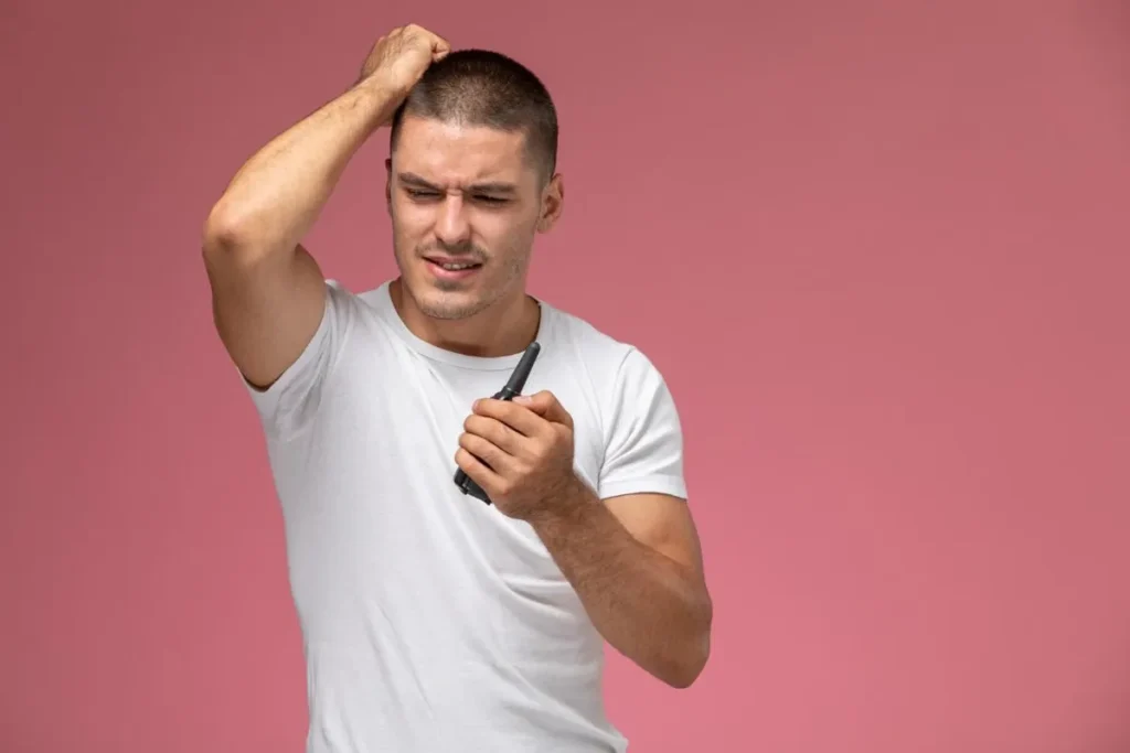 Understanding Balding on Top of Head