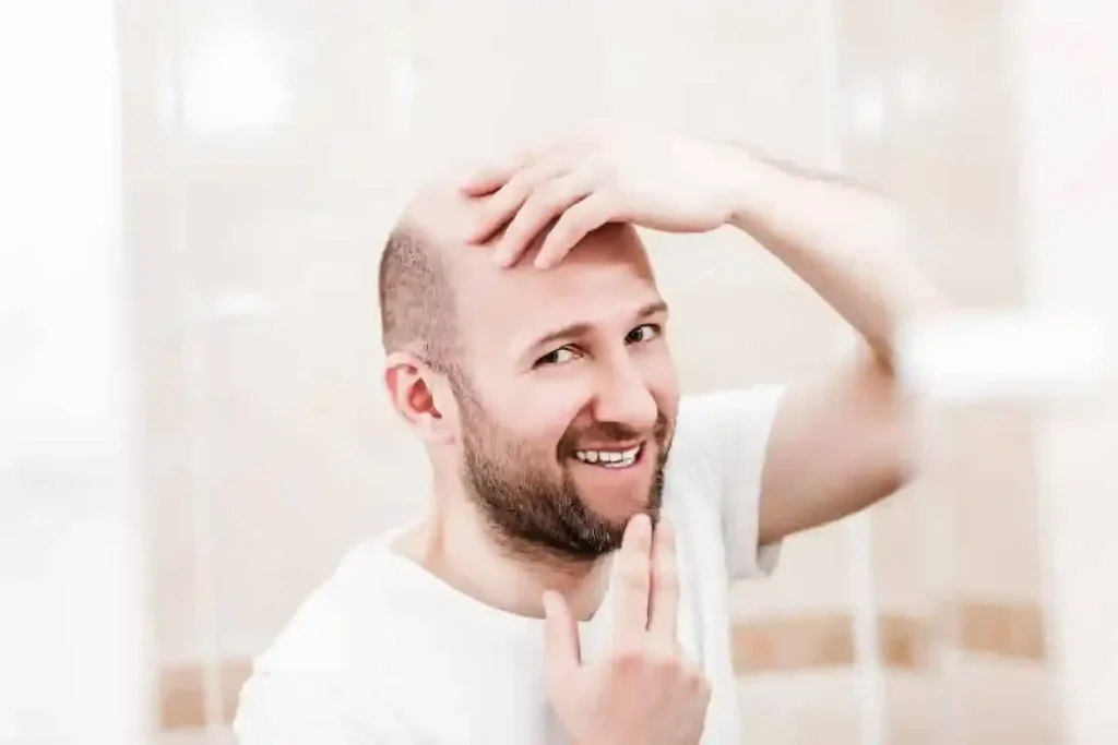 Understanding Hairline Changes